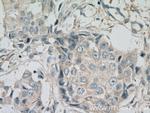 MEK6 Antibody in Immunohistochemistry (Paraffin) (IHC (P))