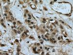 MEK6 Antibody in Immunohistochemistry (Paraffin) (IHC (P))