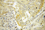 ELP4 Antibody in Immunohistochemistry (Paraffin) (IHC (P))