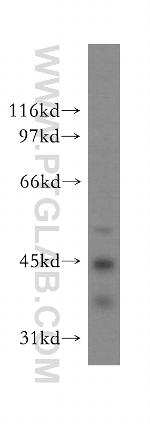 ELP4 Antibody in Western Blot (WB)