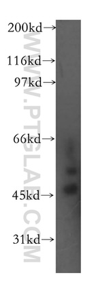 ELP4 Antibody in Western Blot (WB)