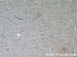PPP2R2C Antibody in Immunohistochemistry (Paraffin) (IHC (P))