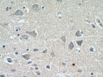 PPP2R2C Antibody in Immunohistochemistry (Paraffin) (IHC (P))