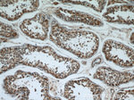 PPP2R2C Antibody in Immunohistochemistry (Paraffin) (IHC (P))