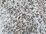 PPP2R2C Antibody in Immunohistochemistry (Paraffin) (IHC (P))