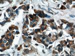 PPP2R2C Antibody in Immunohistochemistry (Paraffin) (IHC (P))