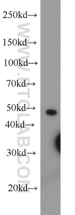 PPP2R2C Antibody in Western Blot (WB)
