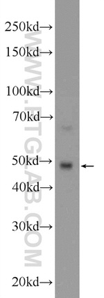 PPP2R2C Antibody in Western Blot (WB)