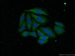 ADAMTS1 Antibody in Immunocytochemistry (ICC/IF)