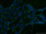 ADAMTS1 Antibody in Immunocytochemistry (ICC/IF)