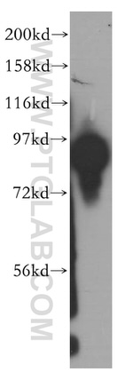 SEC5/EXOC2 Antibody in Western Blot (WB)