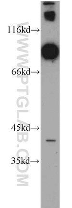 DNAI1 Antibody in Western Blot (WB)