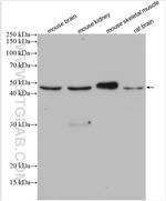 TRIM39 Antibody in Western Blot (WB)