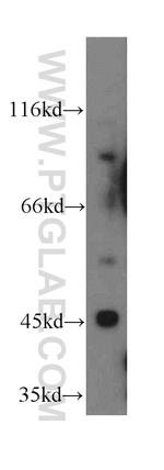 TRIM39 Antibody in Western Blot (WB)