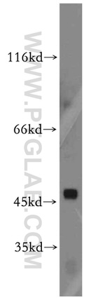 TRIM39 Antibody in Western Blot (WB)