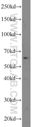RTKN Antibody in Western Blot (WB)
