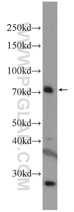 RTKN Antibody in Western Blot (WB)