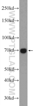 RTKN Antibody in Western Blot (WB)