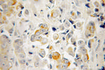 RTKN Antibody in Immunohistochemistry (Paraffin) (IHC (P))