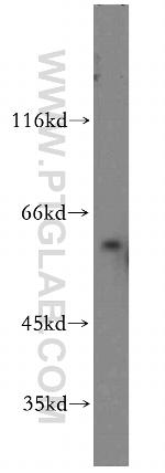 RTKN Antibody in Western Blot (WB)