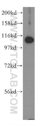 MYCBPAP Antibody in Western Blot (WB)