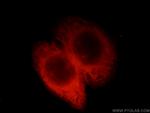 EML1 Antibody in Immunocytochemistry (ICC/IF)