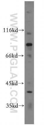 EML1 Antibody in Western Blot (WB)