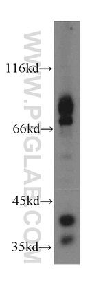 EML1 Antibody in Western Blot (WB)