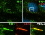 BBS4 Antibody in Immunocytochemistry (ICC/IF)
