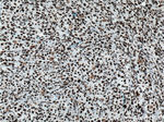 HNRNPD Antibody in Immunohistochemistry (Paraffin) (IHC (P))