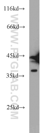 HNRNPD Antibody in Western Blot (WB)