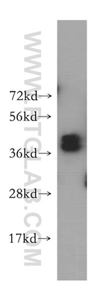HNRNPD Antibody in Western Blot (WB)