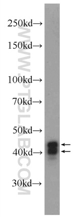 HNRNPD Antibody in Western Blot (WB)