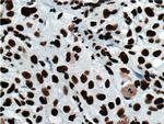 HNRNPD Antibody in Immunohistochemistry (Paraffin) (IHC (P))