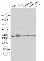 MKRN1 Antibody in Western Blot (WB)