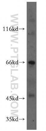 MEIS3 Antibody in Western Blot (WB)