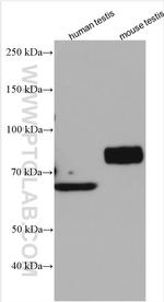 SLC26A8 Antibody in Western Blot (WB)