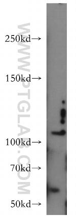 CNTN4 Antibody in Western Blot (WB)