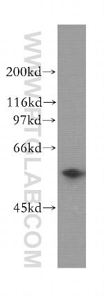 ENPP5 Antibody in Western Blot (WB)