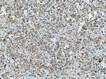 PRKD3 Antibody in Immunohistochemistry (Paraffin) (IHC (P))