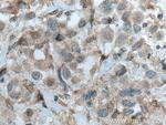 PRKD3 Antibody in Immunohistochemistry (Paraffin) (IHC (P))