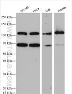 PRKD3 Antibody in Western Blot (WB)