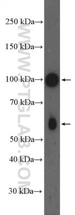 PRKD3 Antibody in Western Blot (WB)