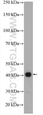 MAGEB4 Antibody in Western Blot (WB)