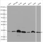 BCL2 Antibody in Western Blot (WB)