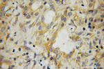 SRFBP1 Antibody in Immunohistochemistry (Paraffin) (IHC (P))