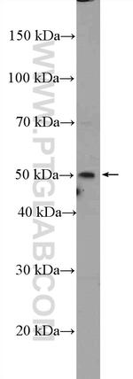 SRFBP1 Antibody in Western Blot (WB)