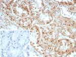 Collagen II (COL2A1) Recombinant Rabbit Monoclonal Antibody (COL2A1/8810R)