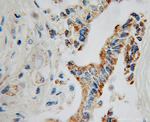 GATM Antibody in Immunohistochemistry (Paraffin) (IHC (P))