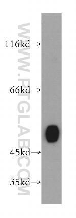 GATM Antibody in Western Blot (WB)